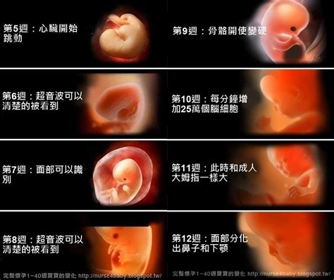 流產胎兒